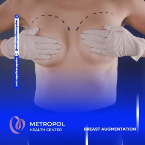 Breast Augmentation Surgery in Izmir Turkey zel Park T p Merkezi